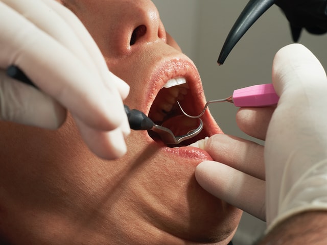 mondhygiënist